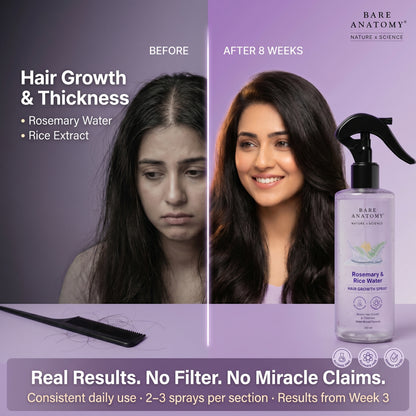 Natural Rosemary Water Spray for Hair Growth & Scalp Care – Anti Hair Fall Hair Mist 100ml